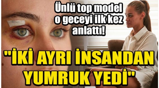 Son dakika... Ukraynalı model Daria Kyryliuk darp iddiasıyla ilgili konuştu.